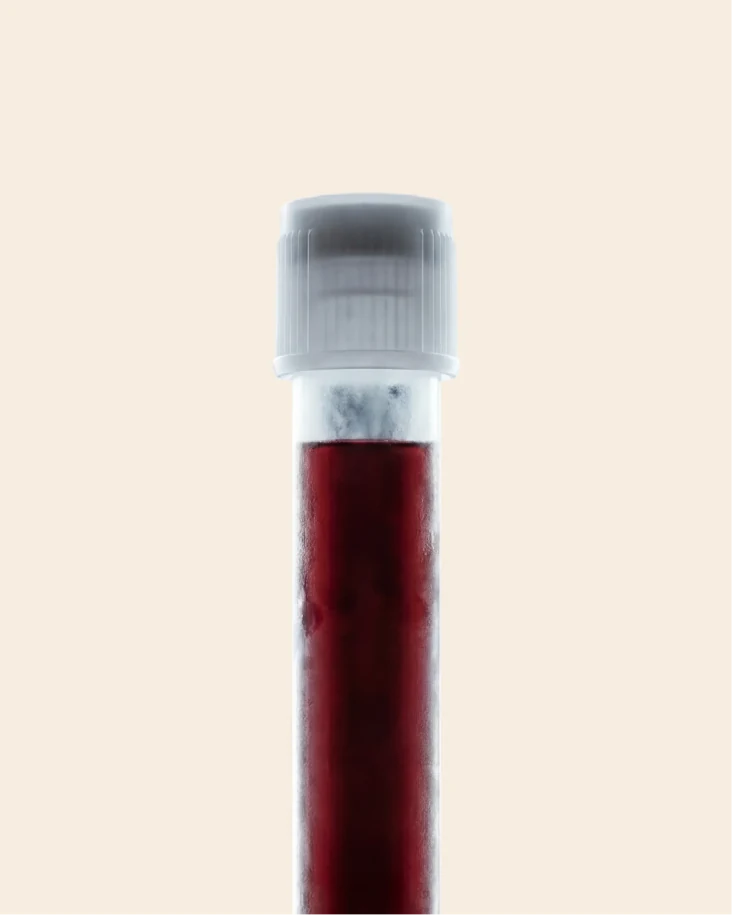 At-Home Blood Test