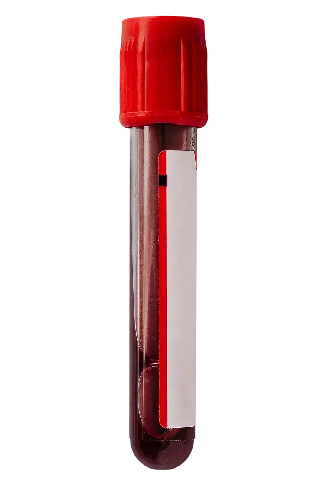 Personalised
lab test