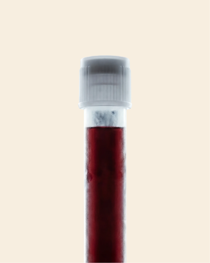 At-Home Blood Test
